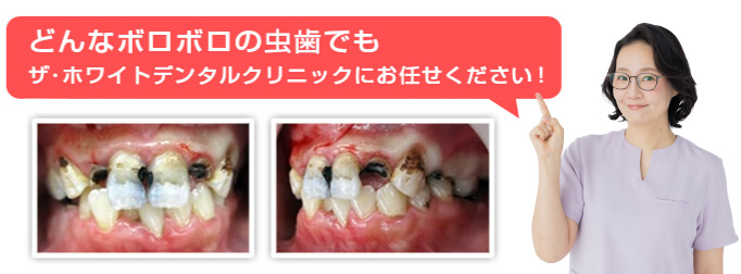 どんな歯でもお任せください！