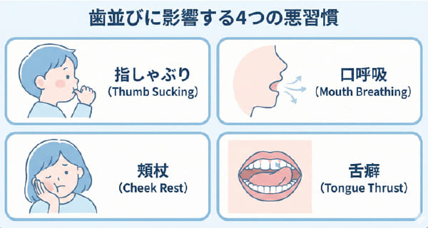 歯並びを悪くする代表的な4つの習慣（指しゃぶり、口呼吸、頬杖、舌癖）