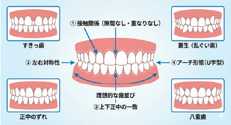 正面から見た歯並びの評価ポイント（歯の接触、対称性、正中の位置、アーチ形態）を示す歯科イラスト図解