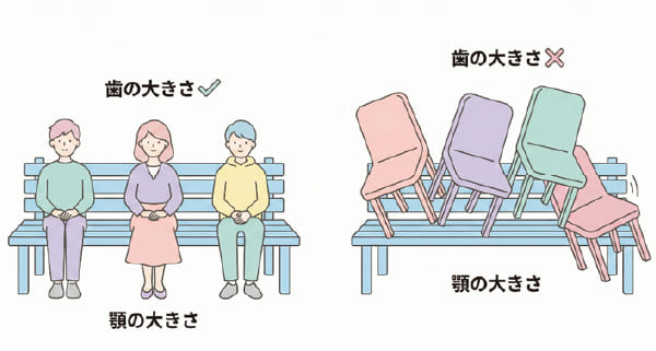 顎の大きさと歯の大きさのアンバランスによる叢生のイメージ図