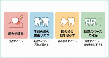 親知らずの抜歯が推奨される4つの主な理由（痛み、虫歯、隣接歯への悪影響、矯正治療）のまとめ図