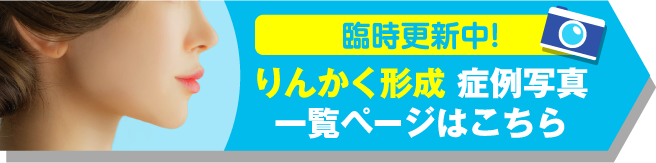 りんかく形成 症例写真一覧ページはこちら