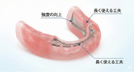 金属フレームで補強され、リライニング（調整）が可能なスマイルデンチャーの内部構造図