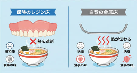 保険の入れ歯（レジン床）と自費の入れ歯（金属床）の厚み・熱伝導性の違いを比較したイラスト