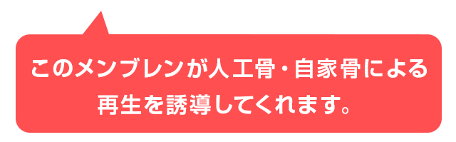 メンブレンが人工骨・自家骨による再生を誘導