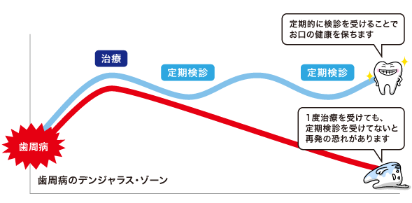 歯周病のデンジャラス・ゾーン