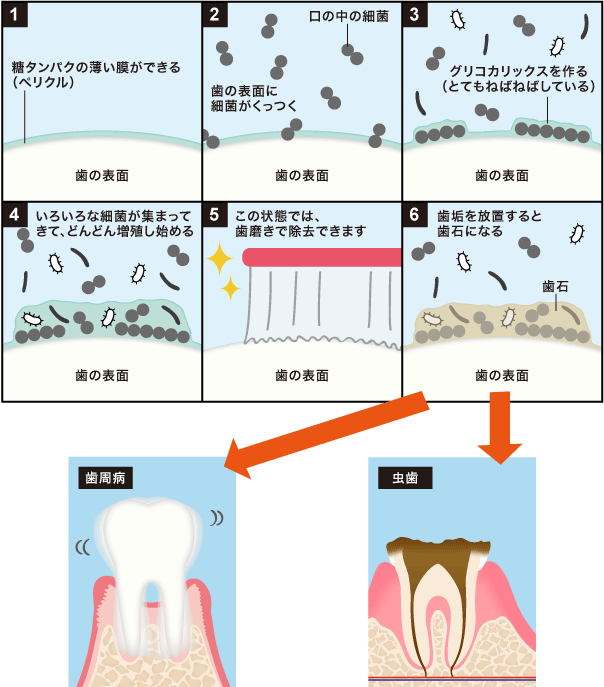 細菌の繁殖