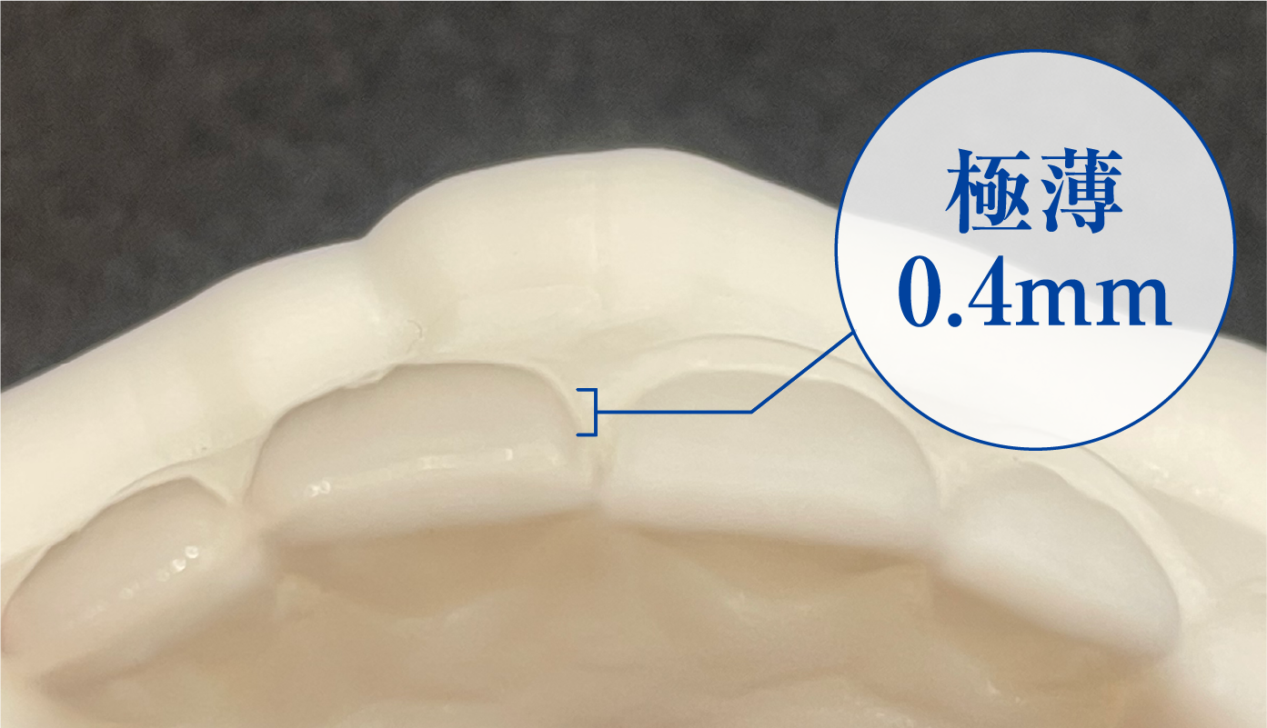 歯の表面に薄いフィルムを貼る審美歯科治療